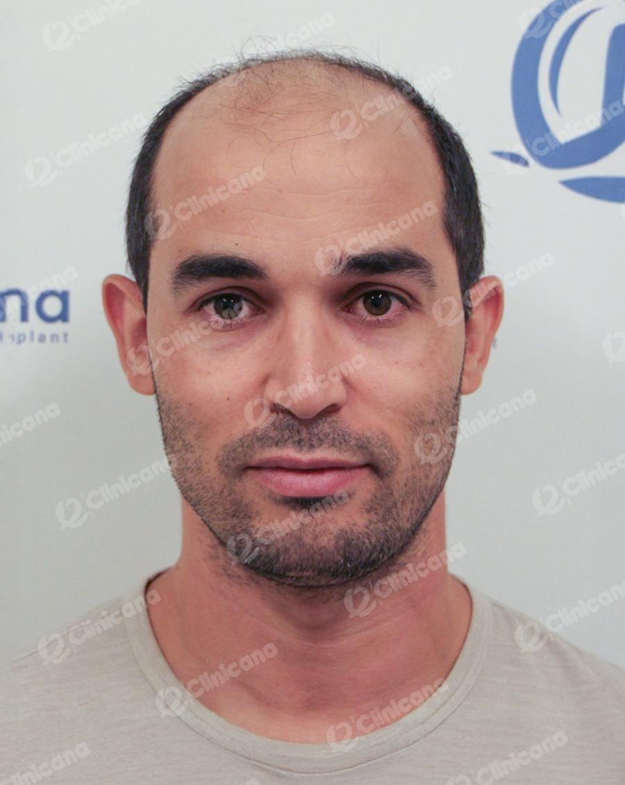 Hairman_img_1_before