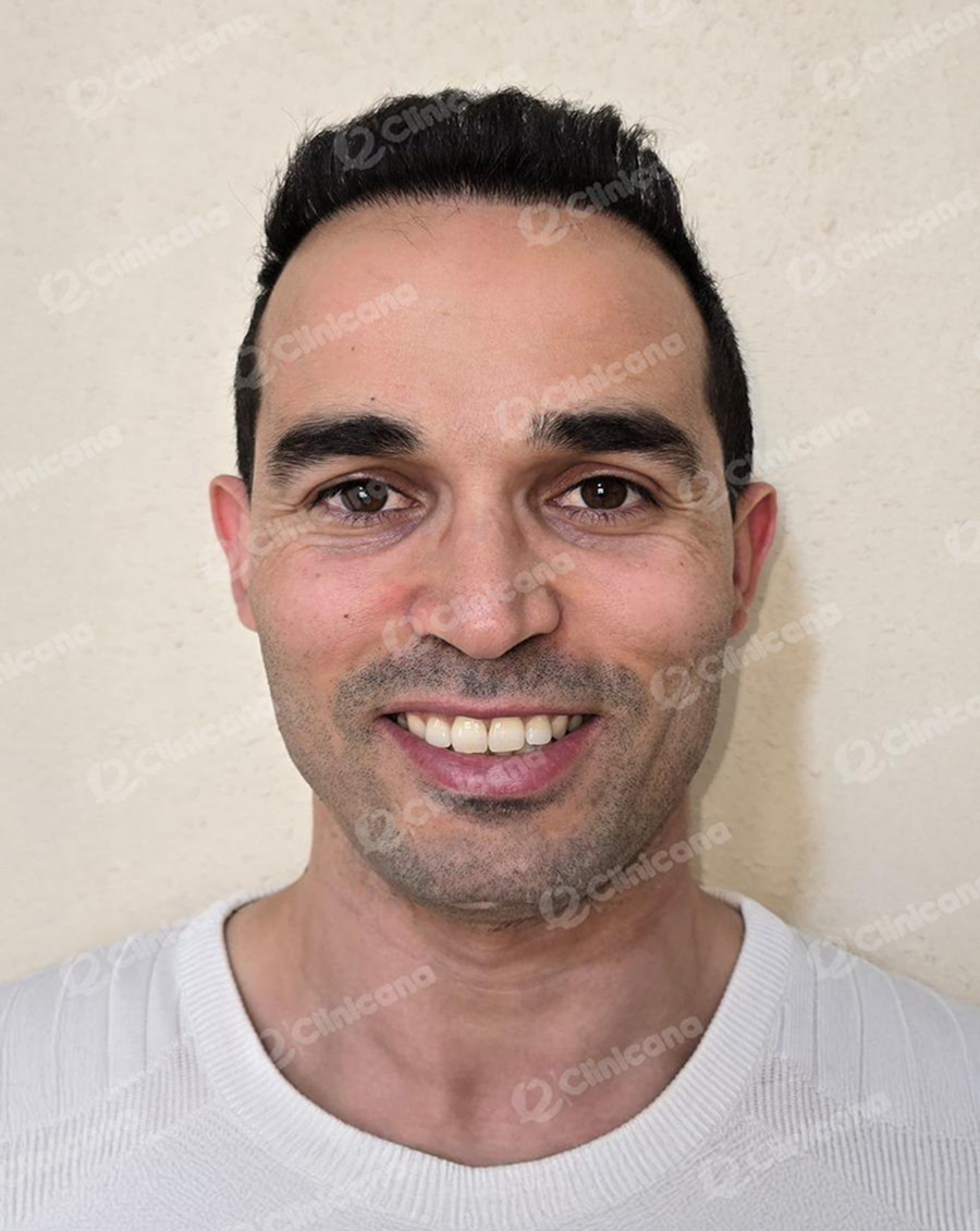 Hairman_img_1_after