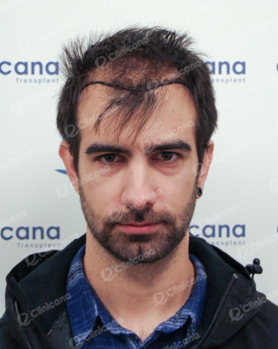Hairman_img_3_before