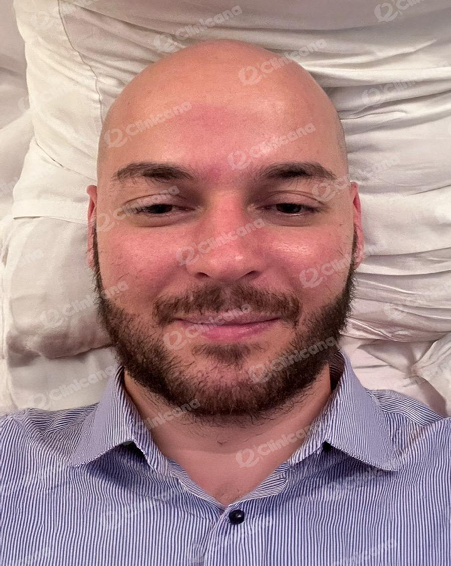 Beard_img_2_after