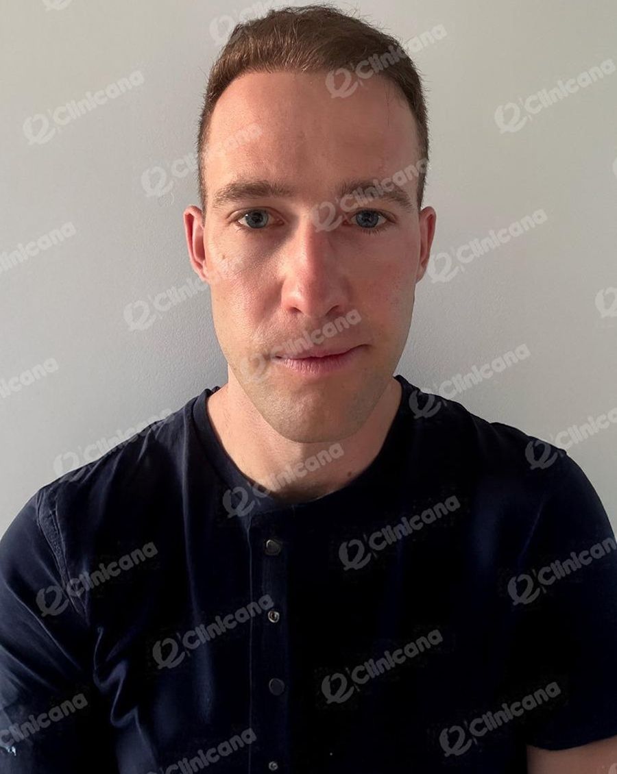Hairman_img_2_after