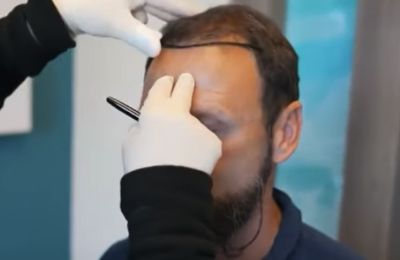 procedure_1